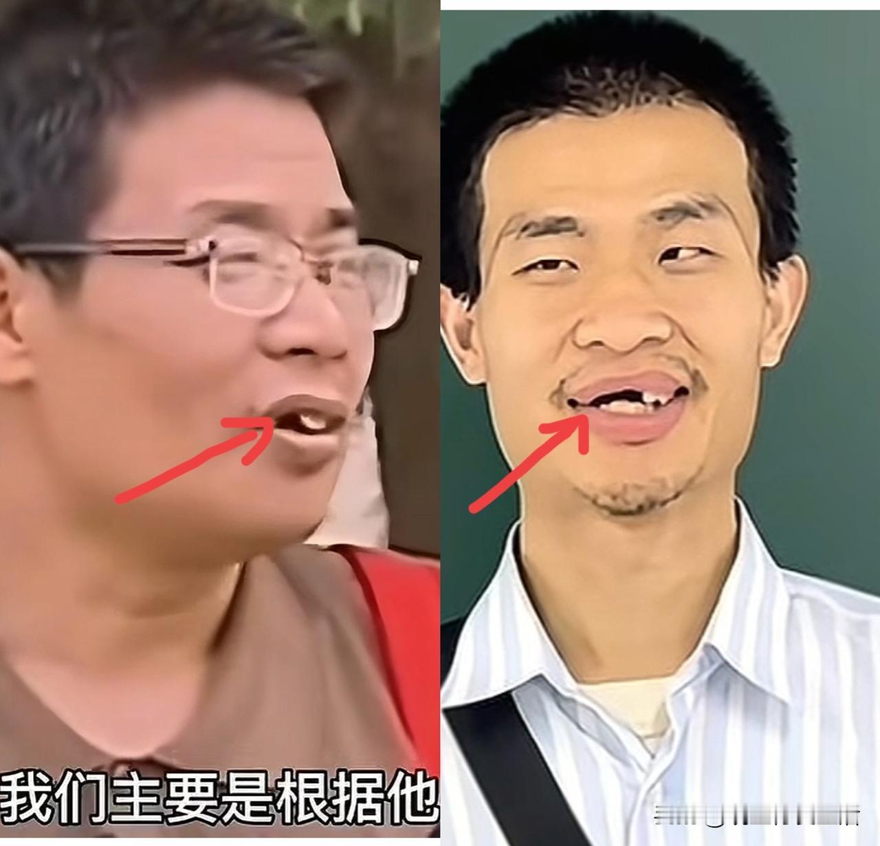 CPU烧干，白愁了？韦东奕的牙齿原来是被父亲带坏的！

牵一“牙”而动全网！一时