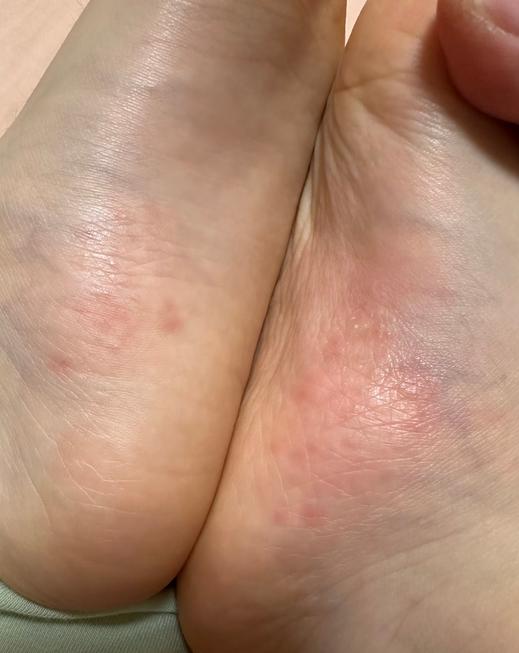浙江，妈妈带着10岁男孩前去游泳，孩子竟查出HPV感染。孩子游泳时状态正常，回家