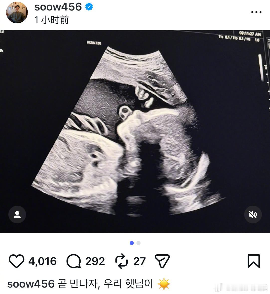 宋承炫当爸宋承炫老婆怀孕 21日，前FTISLAND成员宋承炫晒宝宝B超照，宣布