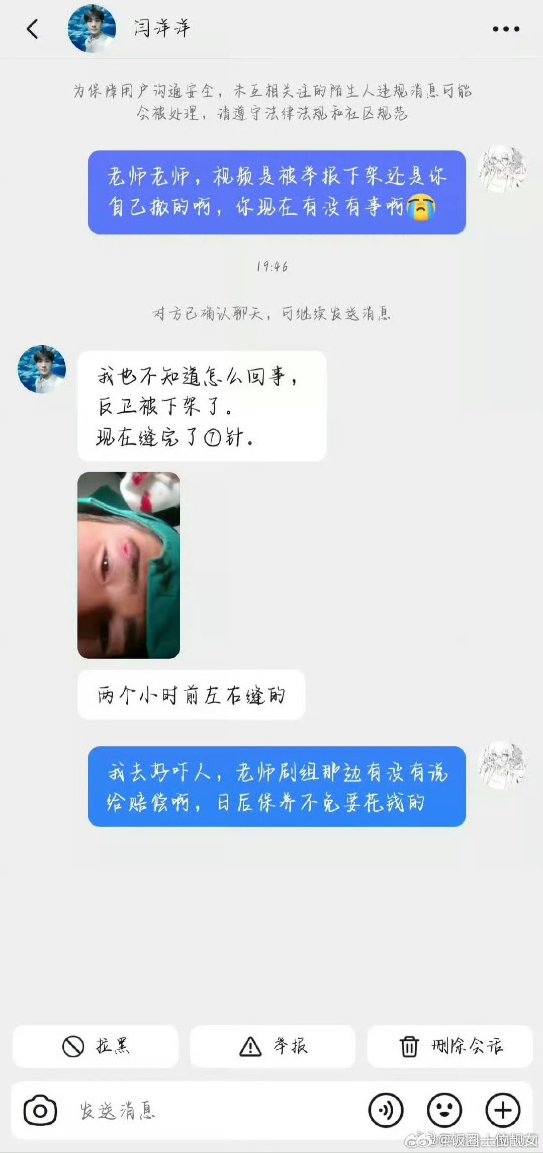 李昀锐刘些宁归良辰剧组演员受伤，剧组竟然不管？现在视频还被强制下架了