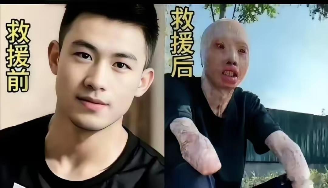 救火英雄救援前与救援后，这就是人民英雄！  救火英雄，救援前义无反顾，救援后满身