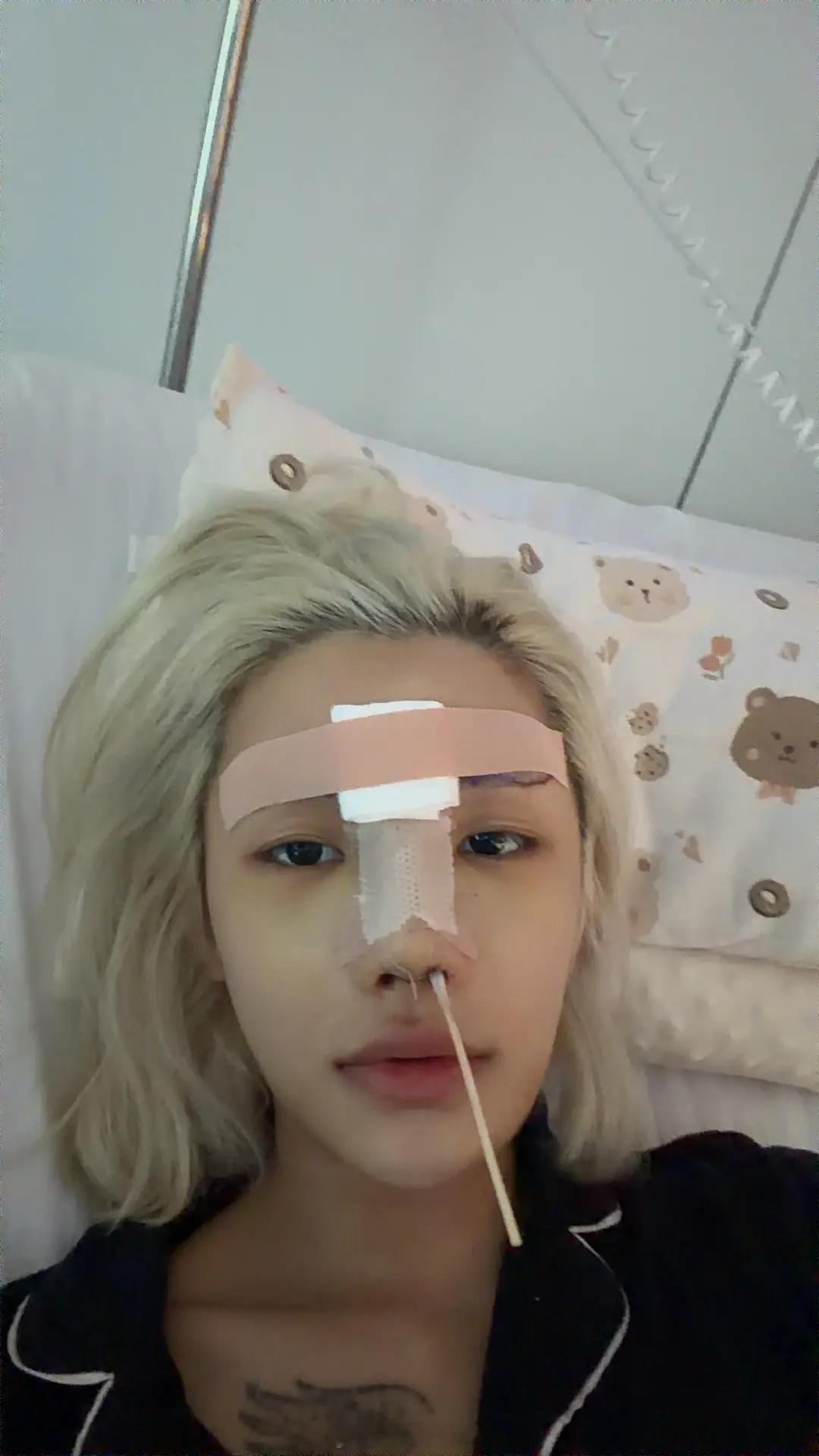 睡醒 终于不肿了 ​​​