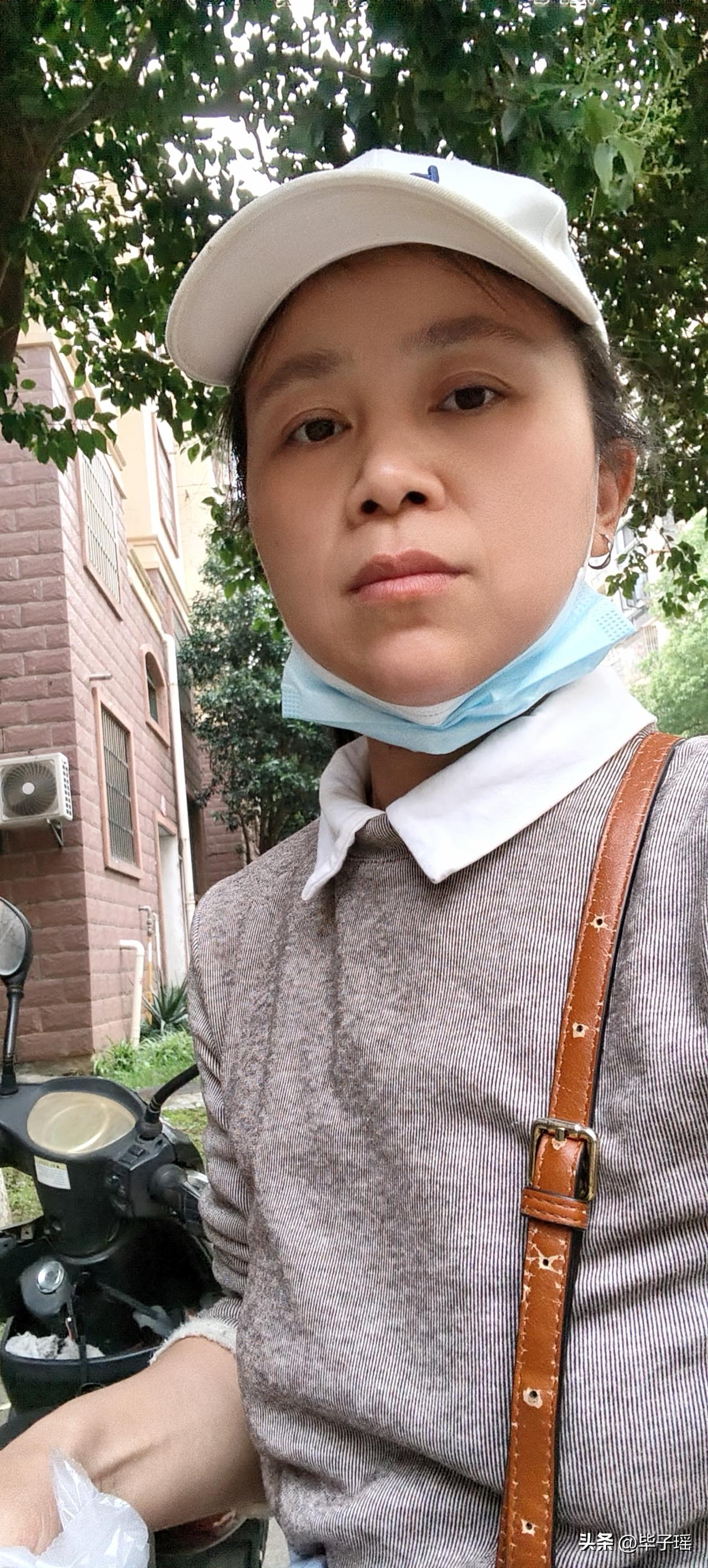 我今年40岁，38岁确诊宫颈癌早中期做完子宫和卵巢双切除，又做了同步的放化疗，两
