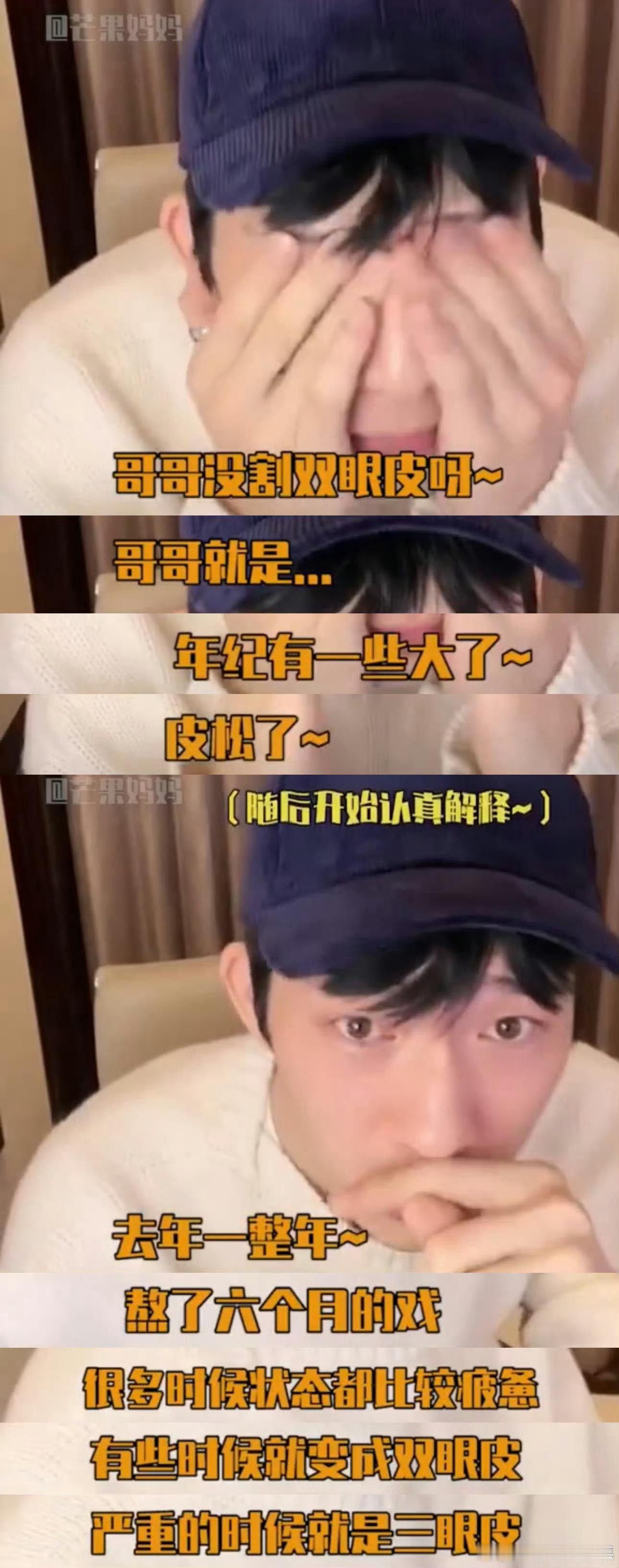 井柏然双眼皮 年纪大了皮松了哈哈哈哈哈哈哈太可爱了，不过，依旧很帅啊，到底谁在说