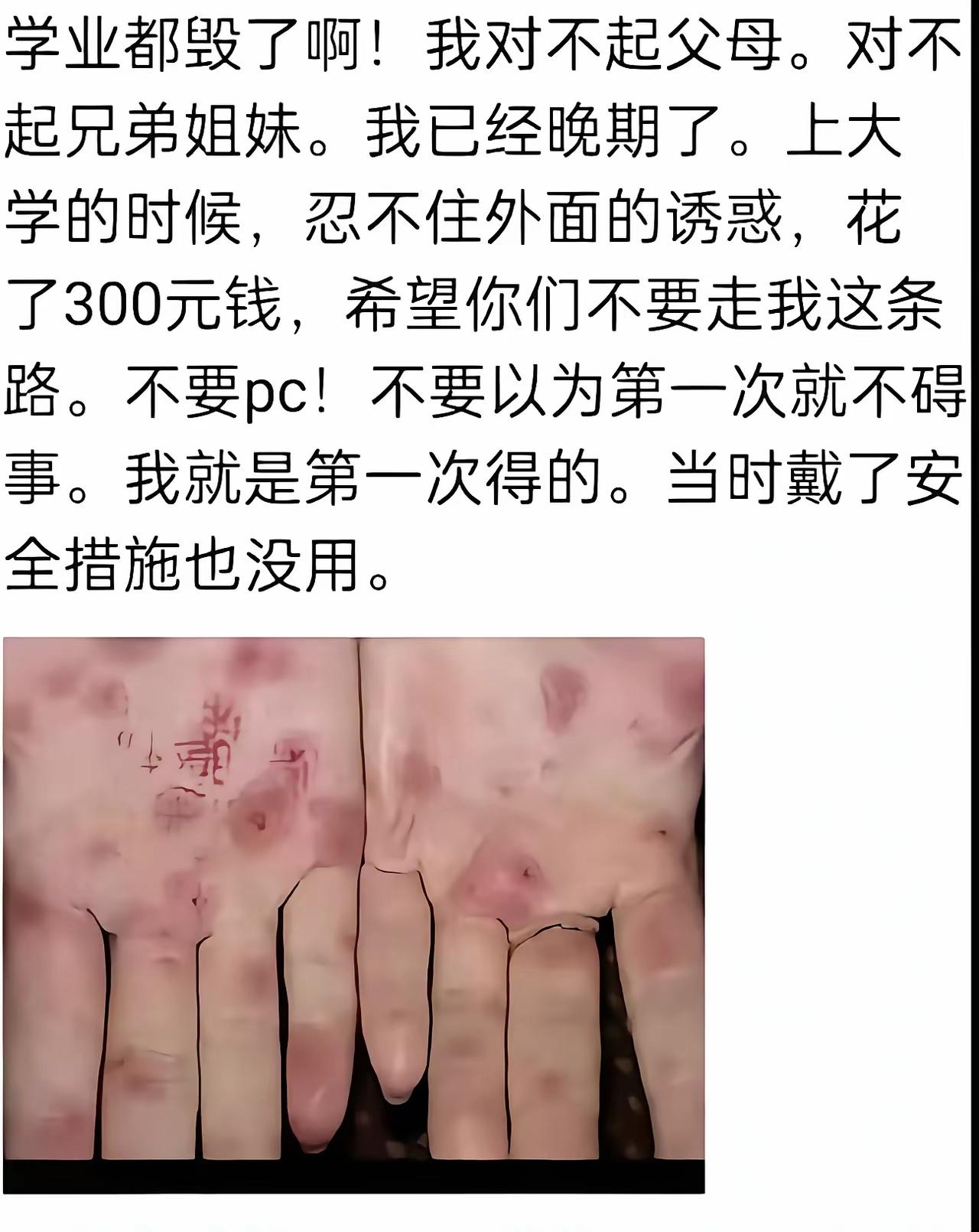 这是中奖的感觉了，现身说法。