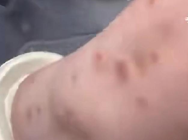 现在的人可能不认识臭虫了，90年代去过广东打工的人，才能知道什么是臭虫，这种虫夜