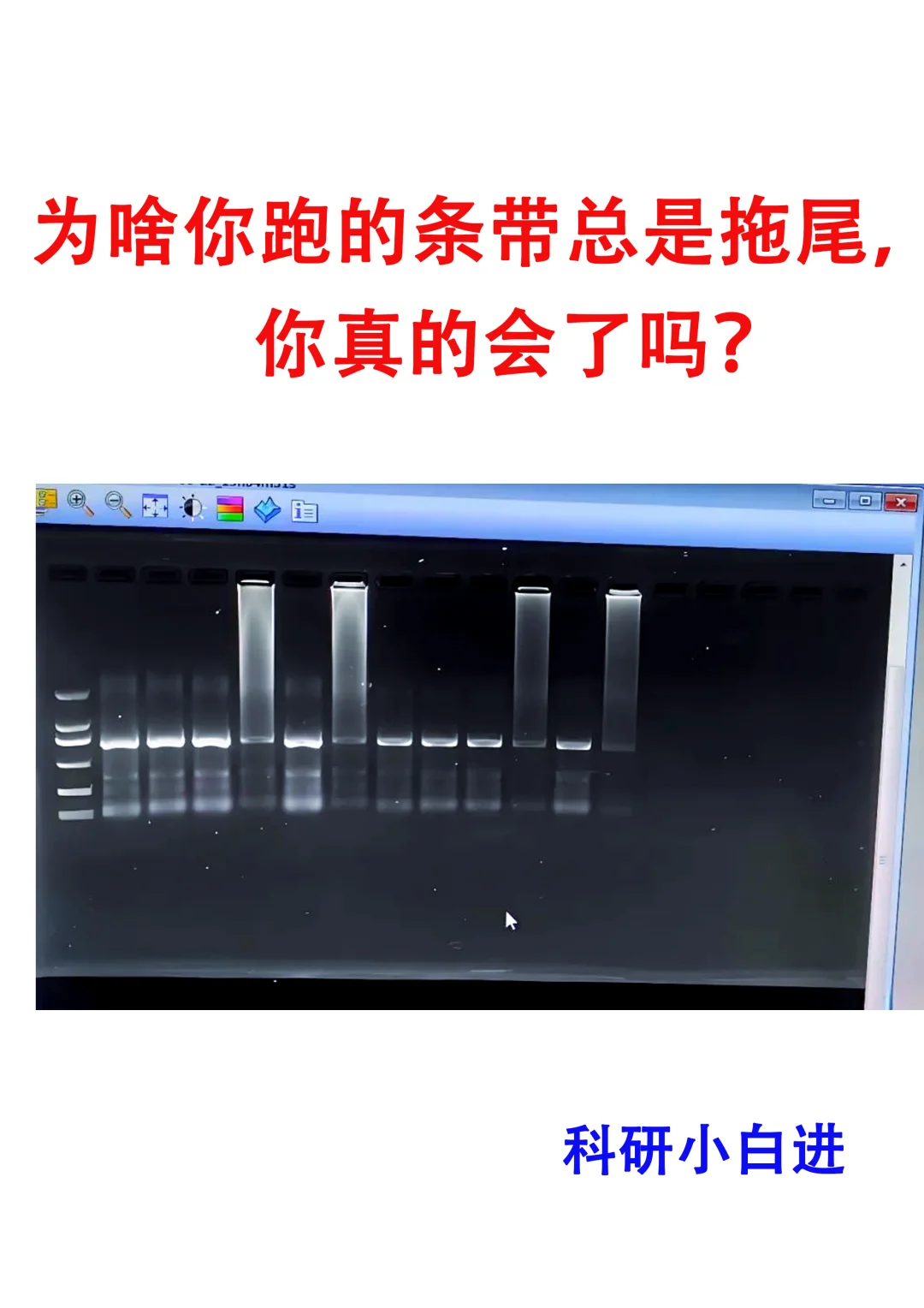 🔥为啥你跑的条带总是拖尾，你真的会了吗？