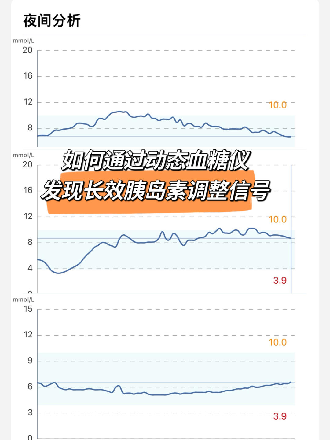 1型糖友必看！从动态图谱发现长效调整信号