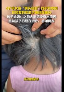 贵州毕节，4岁半女童半年内头发大面积变白，家长辗转多家医院始终查不出病因。无奈之