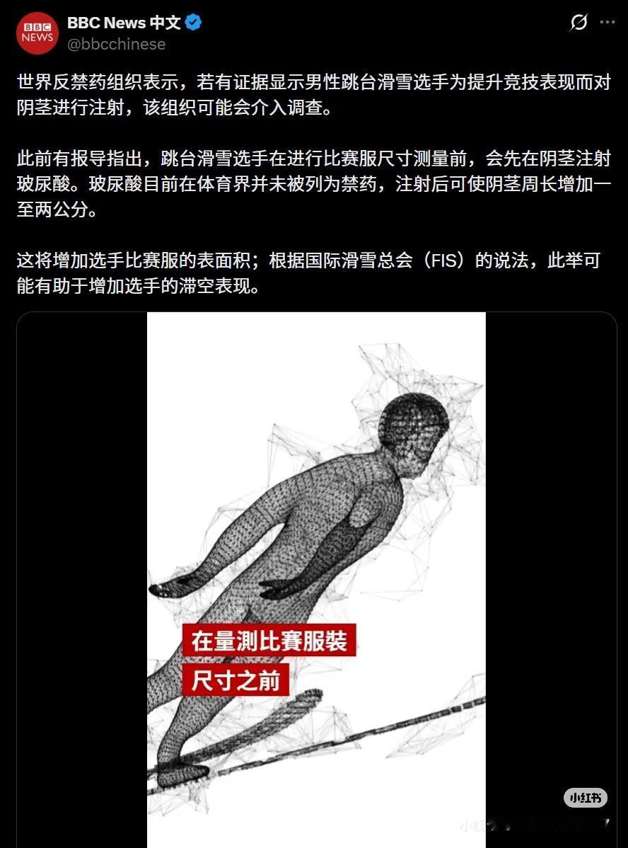 哈？不认识字了🙊 