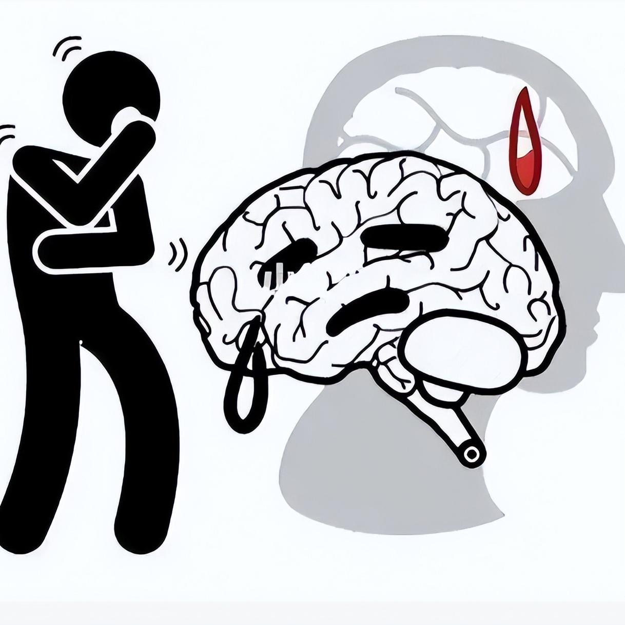 偏瘫初期别急着练走路！先做好这三件事，比啥都强

很多家属一听说康复，就急着让患