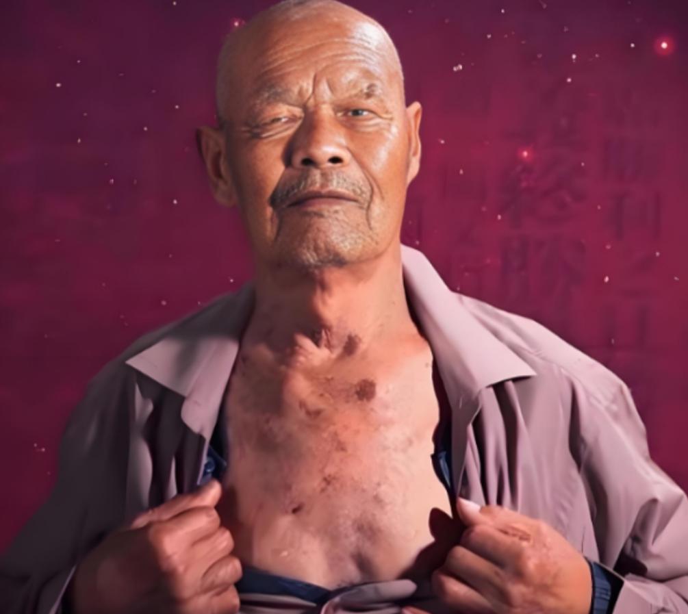 1956年，35岁的农民咳嗽10年，但却一直拒绝就医，一天，他突然用力一咳，一个