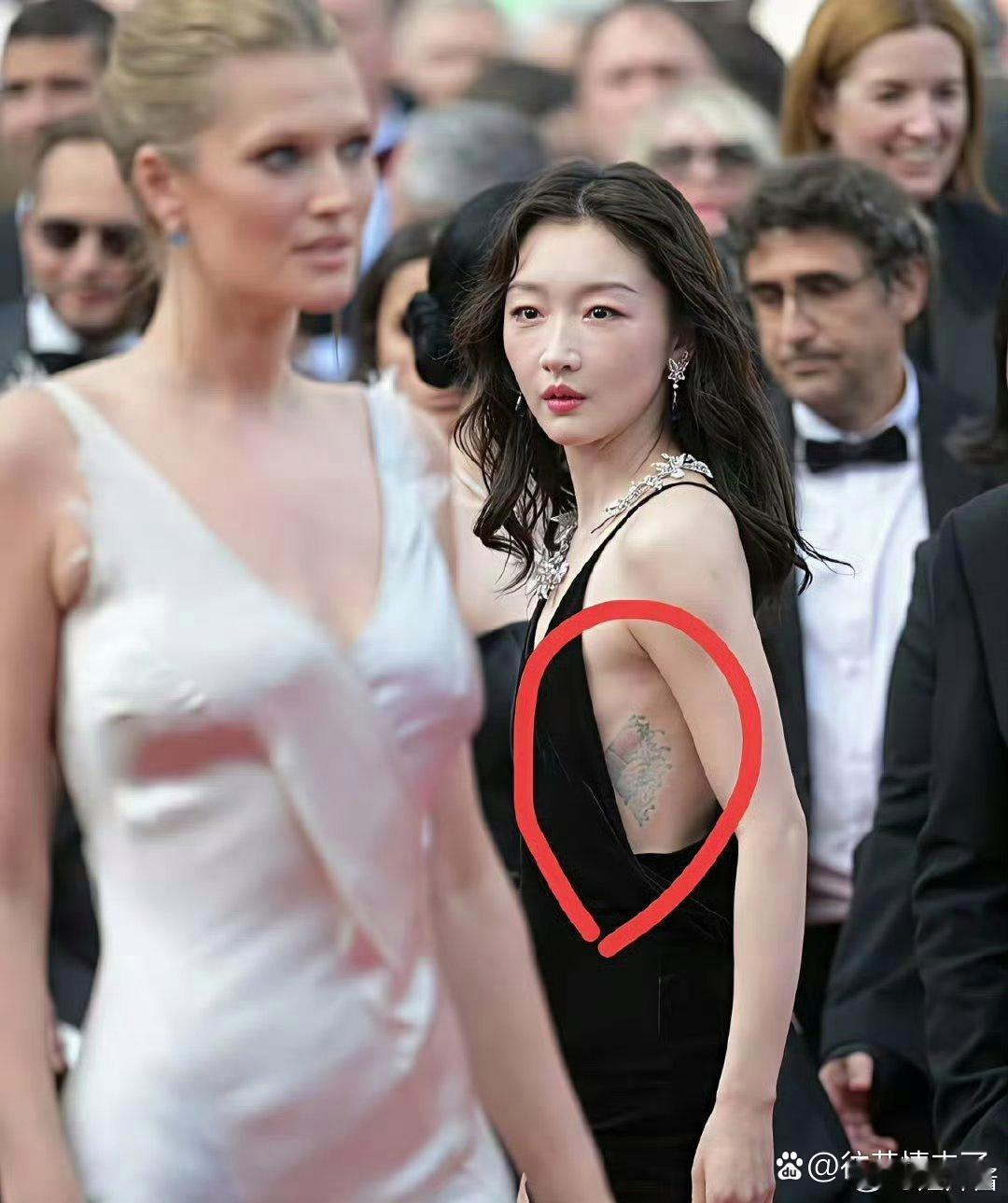 这个位置应该很疼吧 ​​​