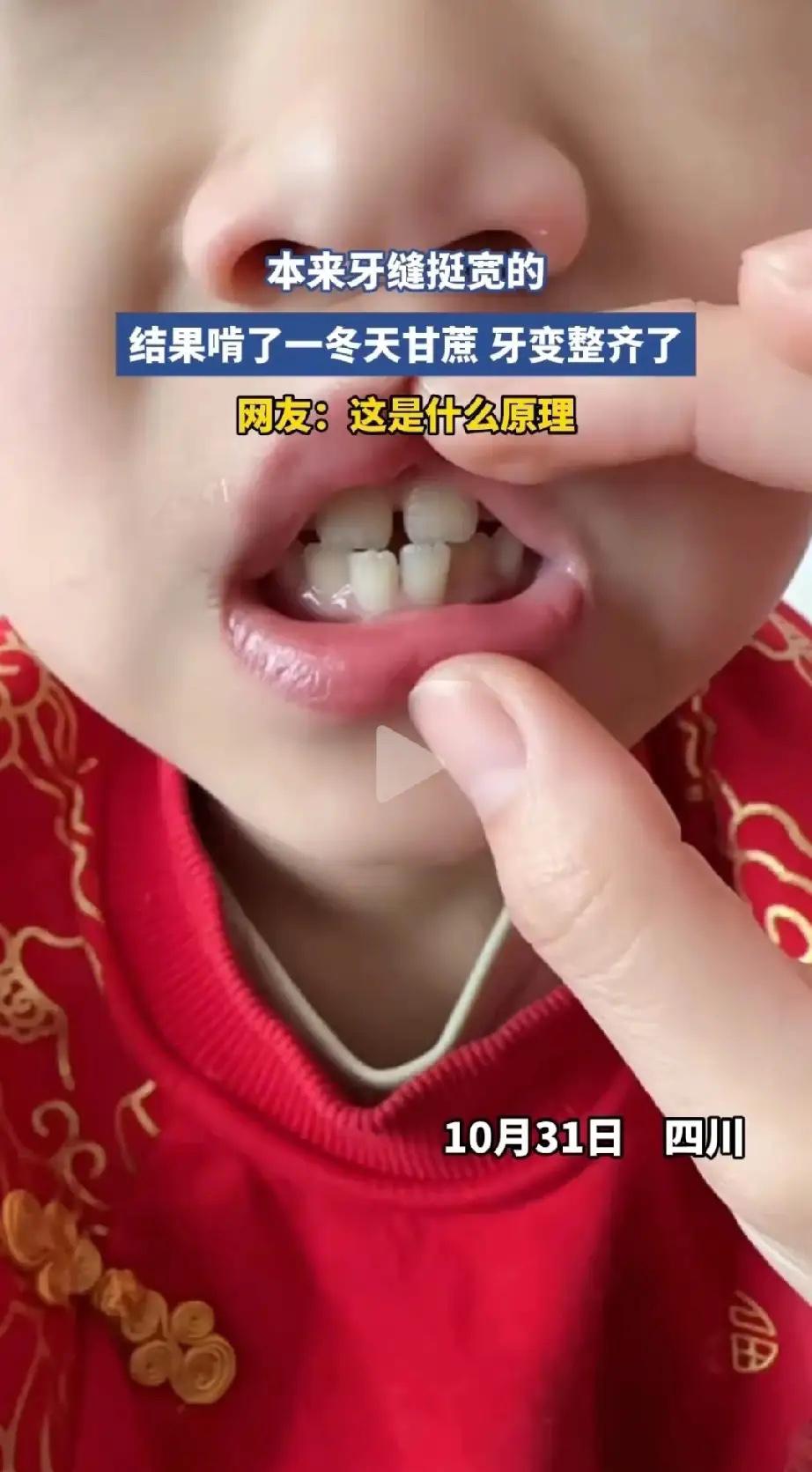 吃甘蔗是真的有用，刚看到一个宝妈说她家孩子牙齿不齐，牙缝太大，结果啃了一冬天的甘