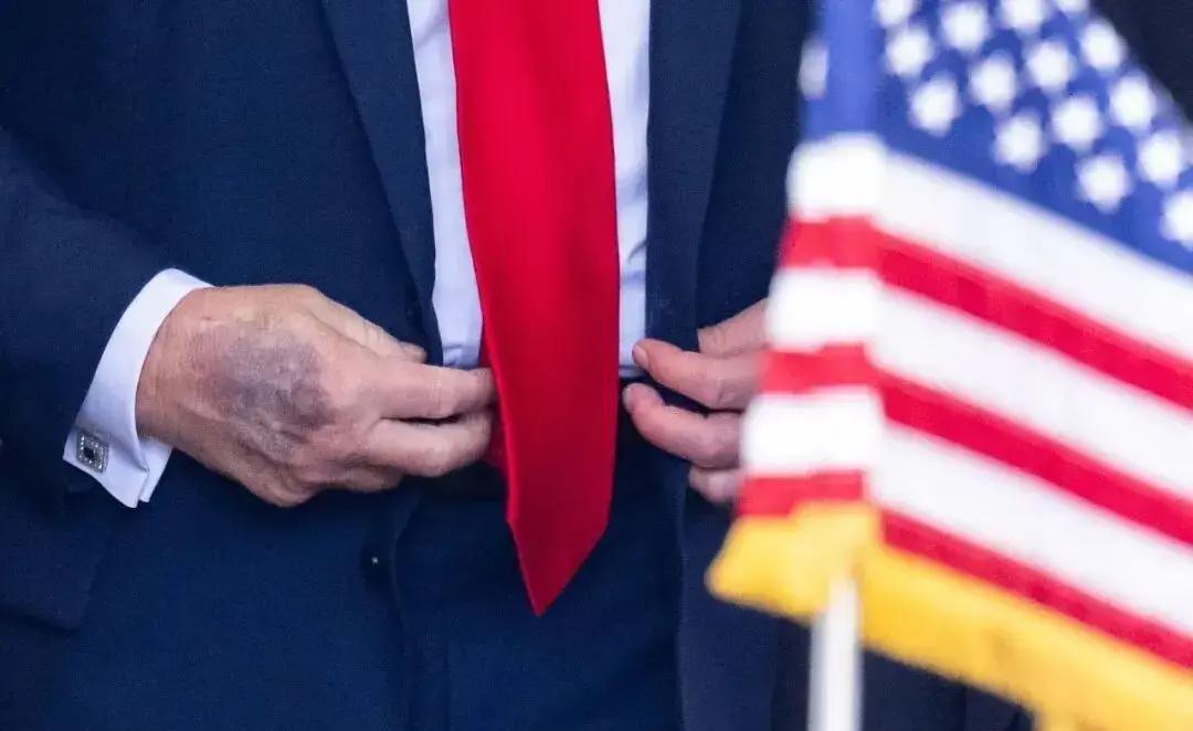 快讯！
美国总统特朗普突然宣布了。
近期在一次采访里，79岁的特朗普把右手背的瘀