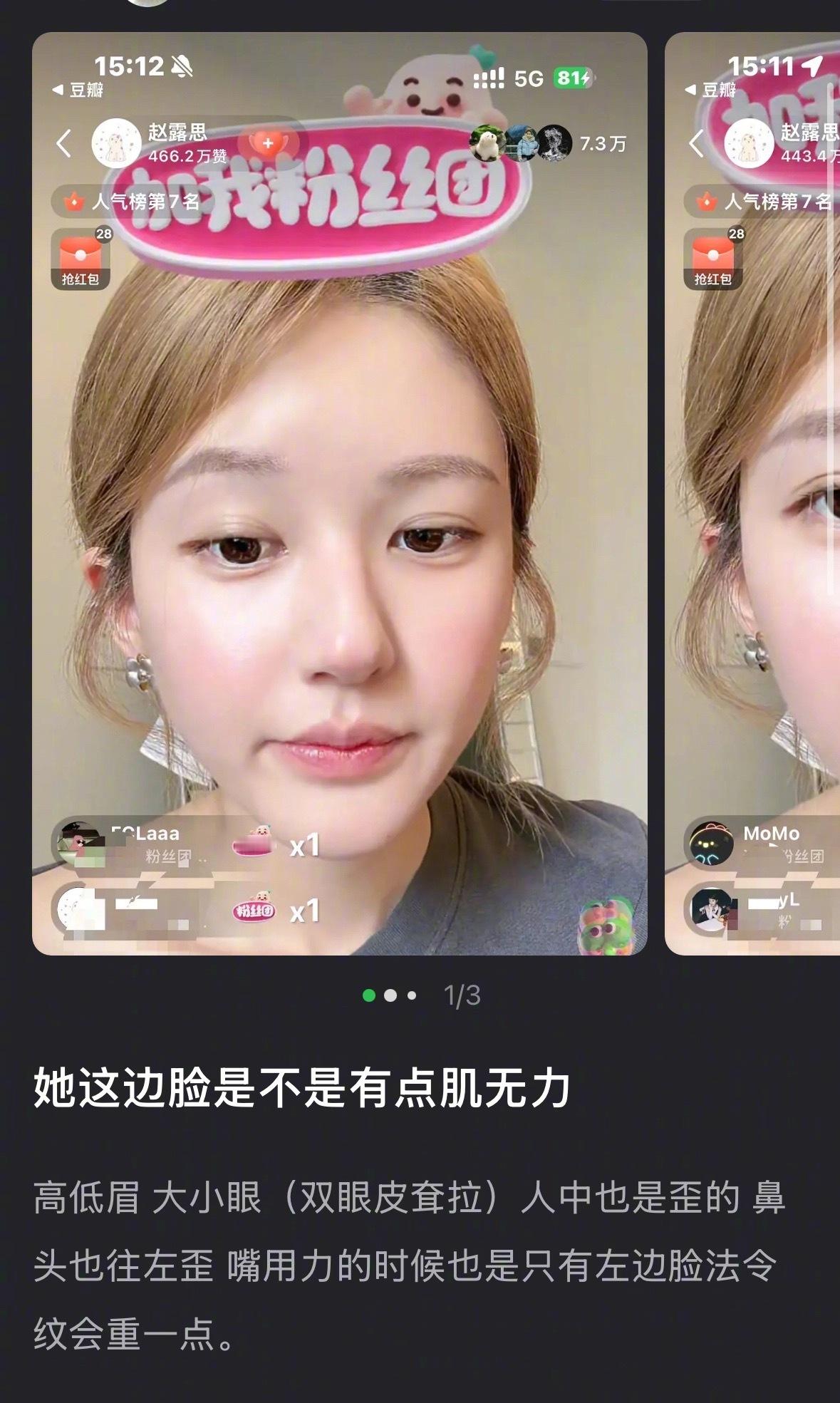 赵露思的脸被指有点肌无力，看得出来吗？ ​​​