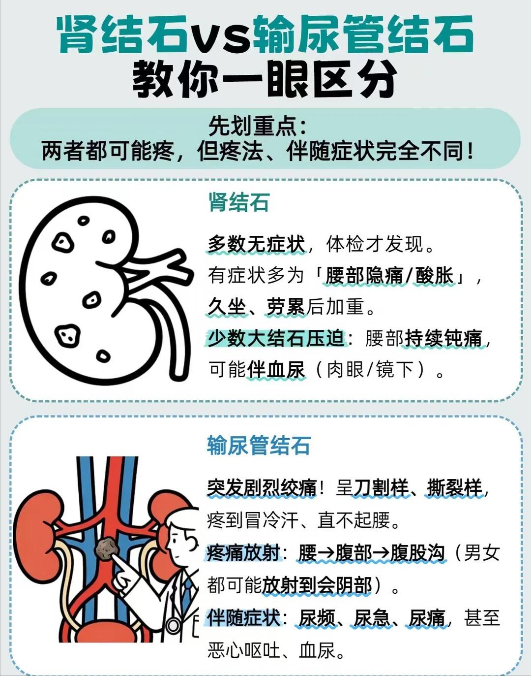 结石疼痛别混淆，分清肾结石与输尿管结石，少走弯路
