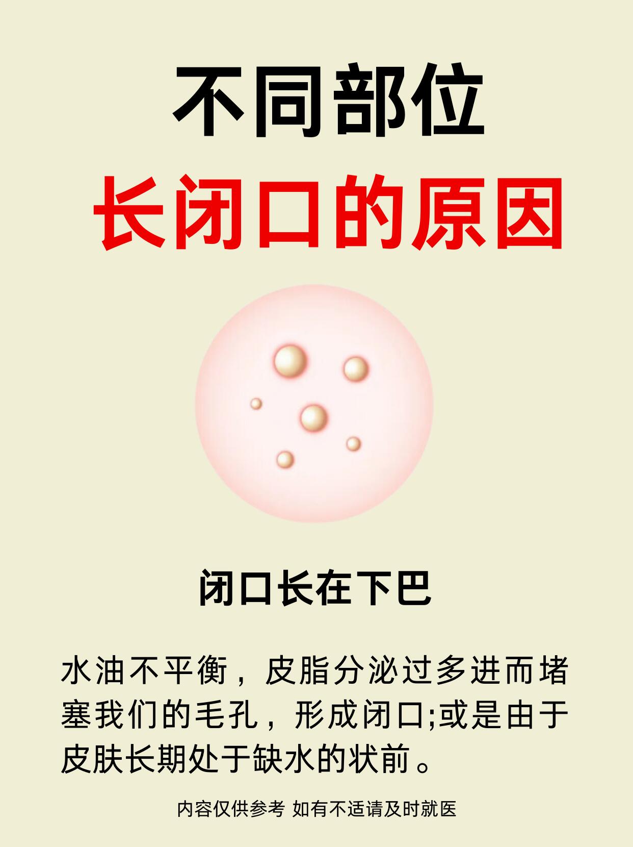 不闭位置长闭口?是什么原因?闭口痘痘反复长闭口怎么办