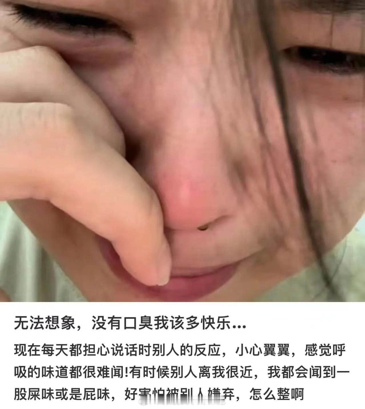 很多人来肝胆外科看口臭！  以为口臭是肝不好[允悲][允悲][允悲]一位满口黄斑