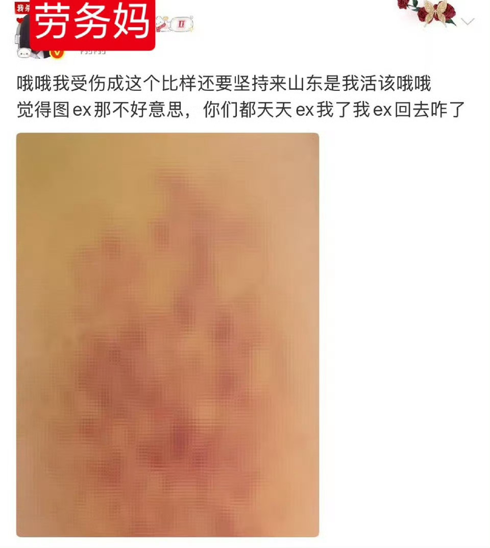 这也好b意思卖惨？