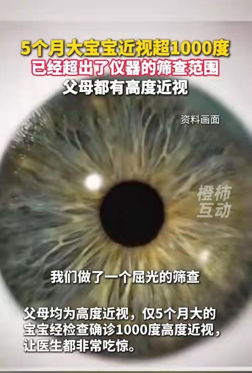 天塌了！原来近视真的遗传。西安一对夫妻，两人都是高度近视，心里本身就揣着块石头，