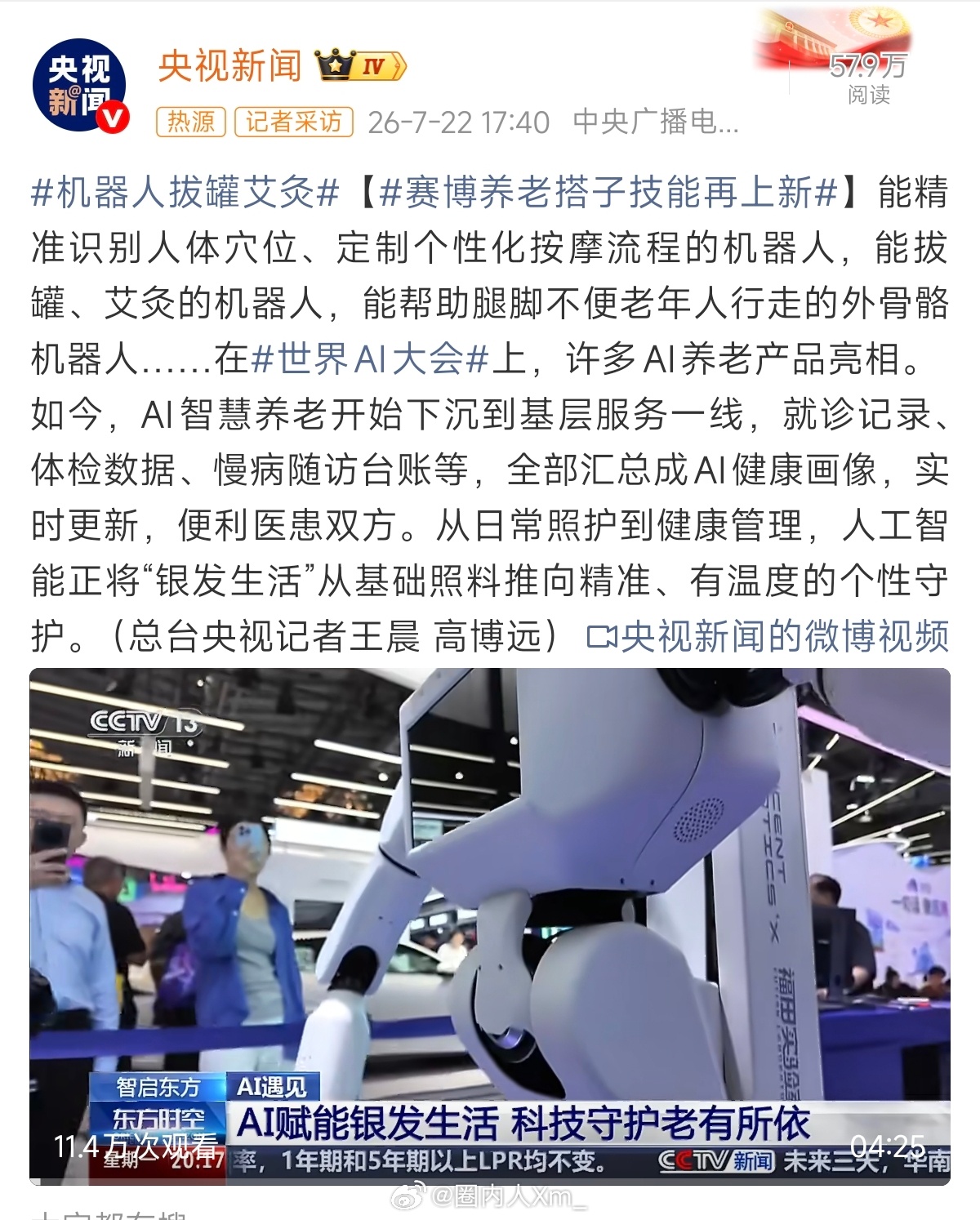 机器人拔罐艾灸这可以啊拔个罐，除除湿气 