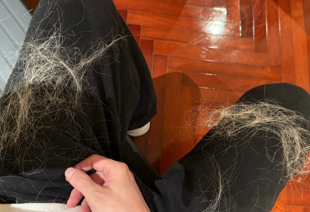 薛之谦斑秃原因薛之谦斑秃原因有了 心疼老薛薛之谦