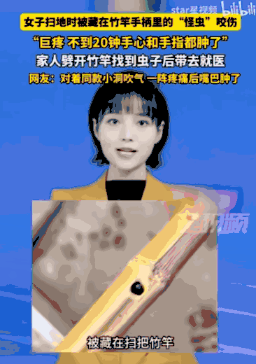 万万没想到！四川雅安，一位女子在家里扫地时，竟被扫把柄里窜出的一只“怪虫”狠狠咬