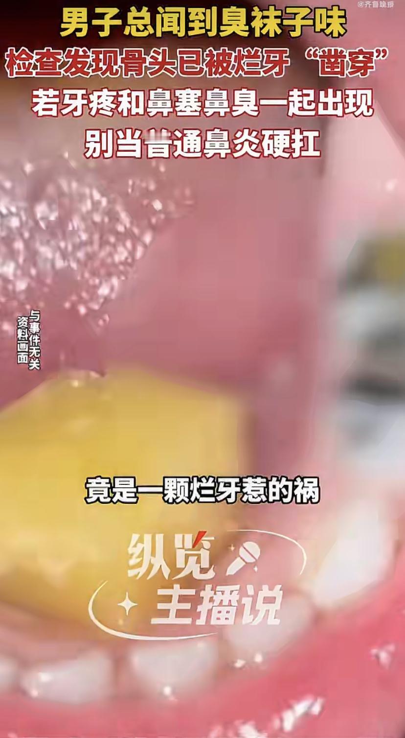 30岁小伙总闻到臭袜子味，一查竟是烂牙惹的祸!
杭州一位30岁的小陈最近总被一个