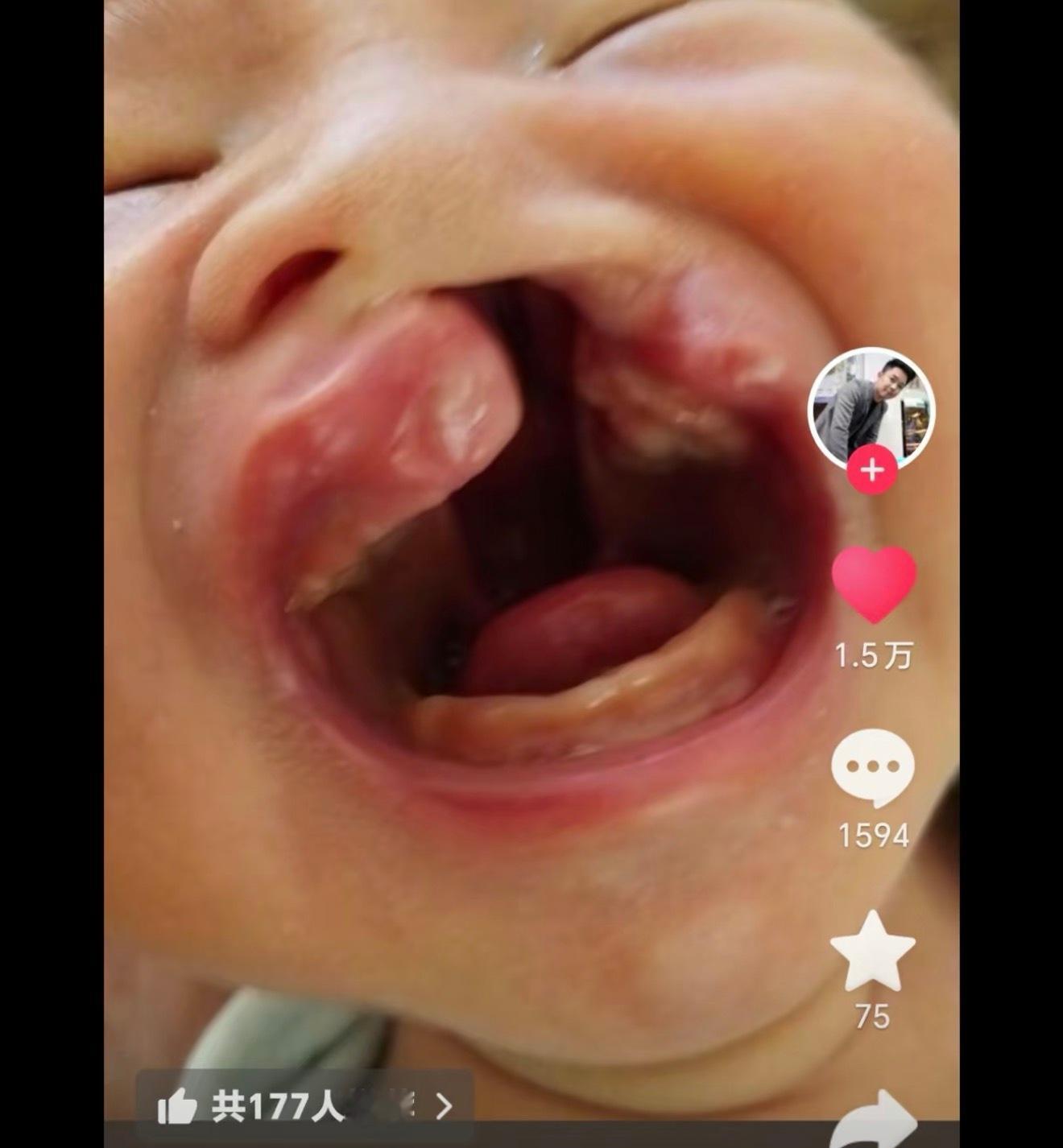 昨天完整的看了李亚鹏关于北京嫣然天使儿童医院的视频，专门去抖音搜了一下，很多在嫣