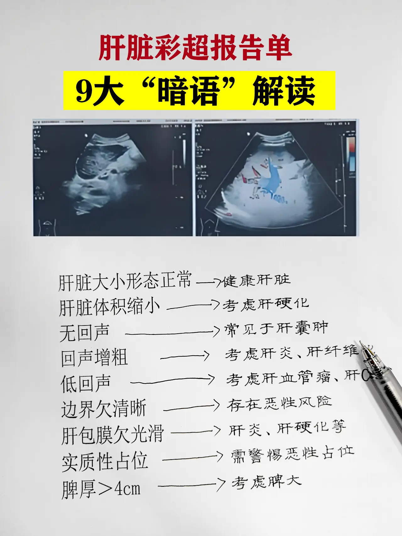 肝脏彩超 乙肝 肝硬化 肝炎 山东肝病吴龙奇