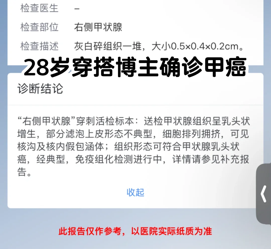 得甲癌的治疗与心理过程