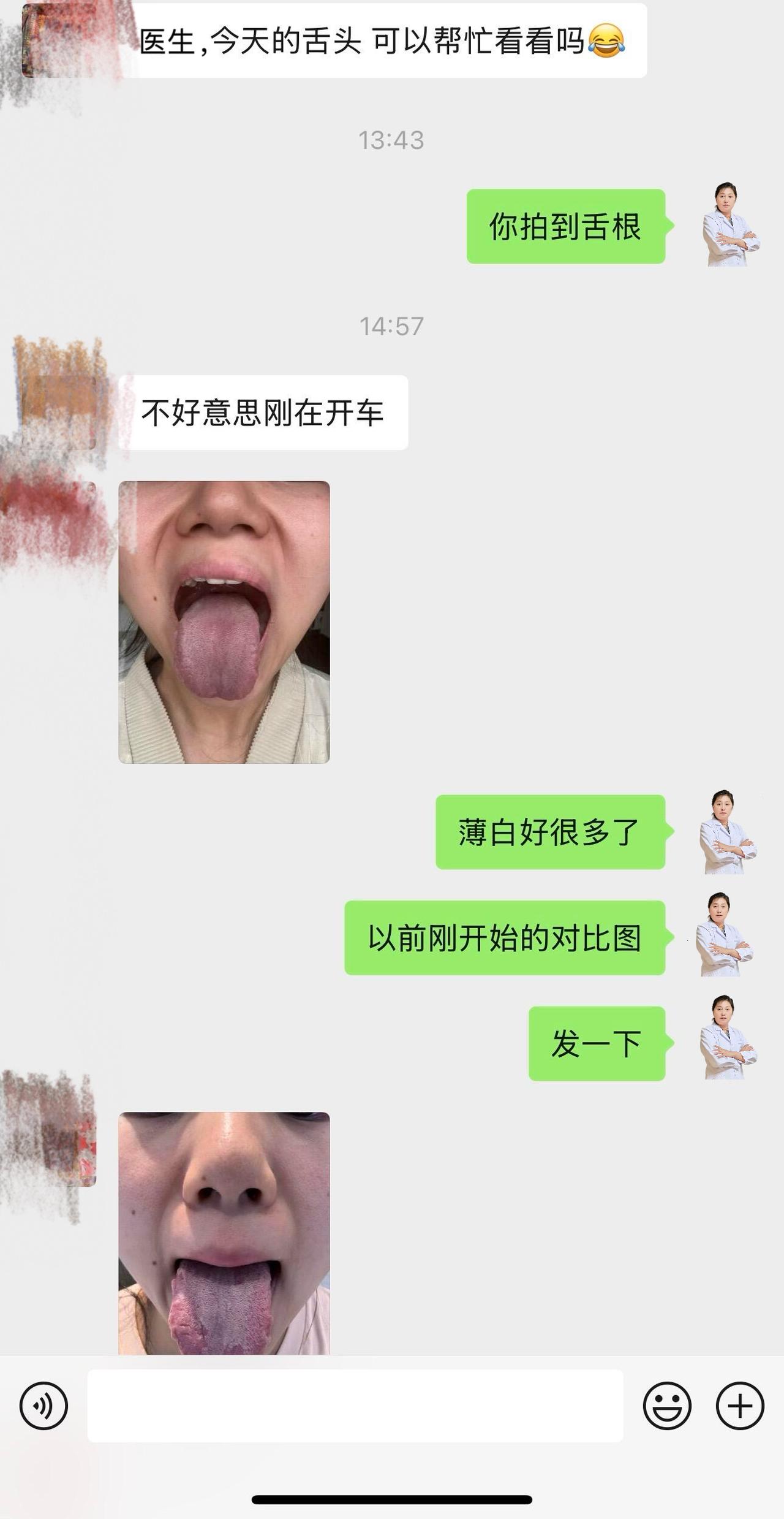收到患者最新舌照
对比初诊变化很欣慰