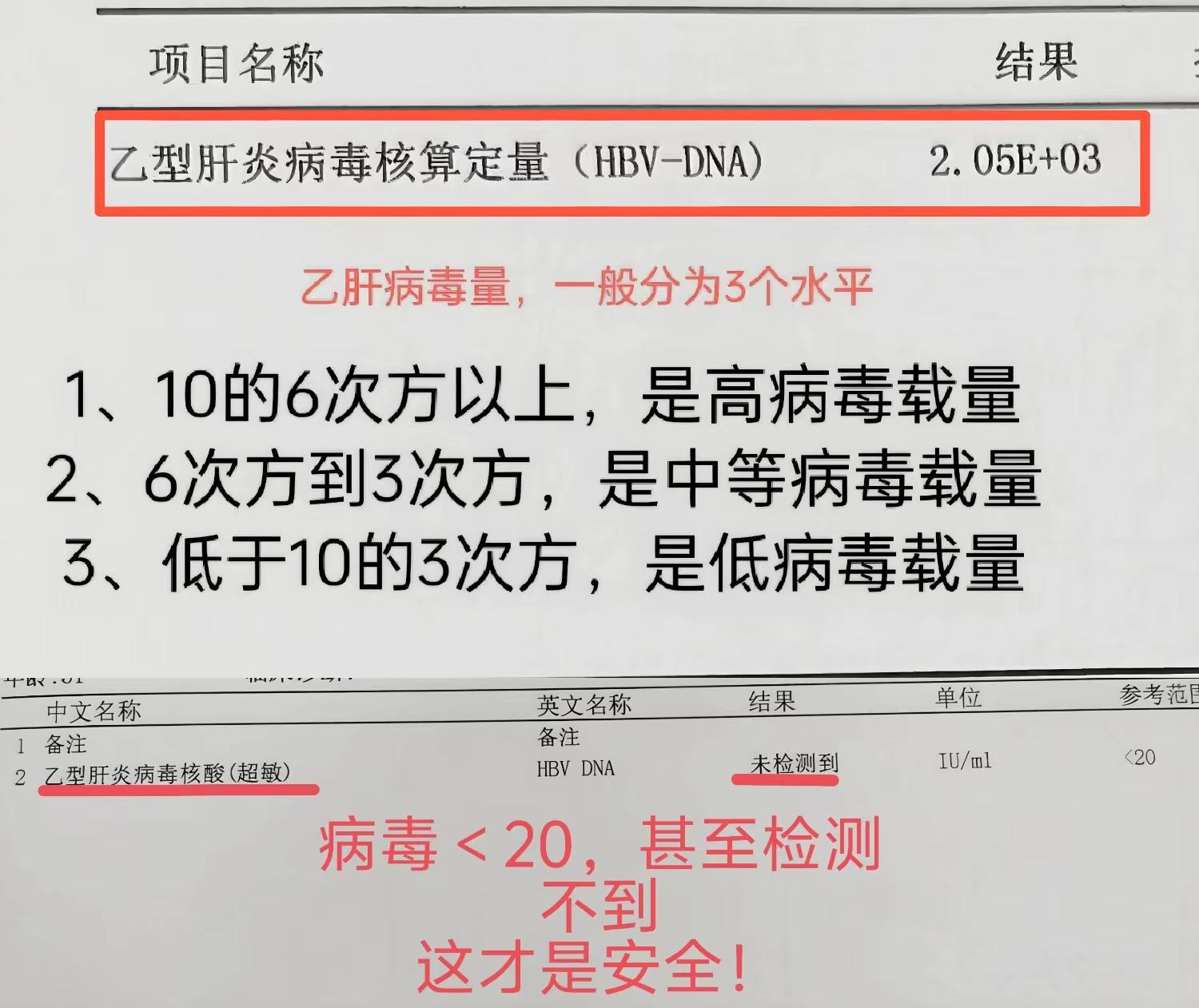山东 乙肝 医学科普