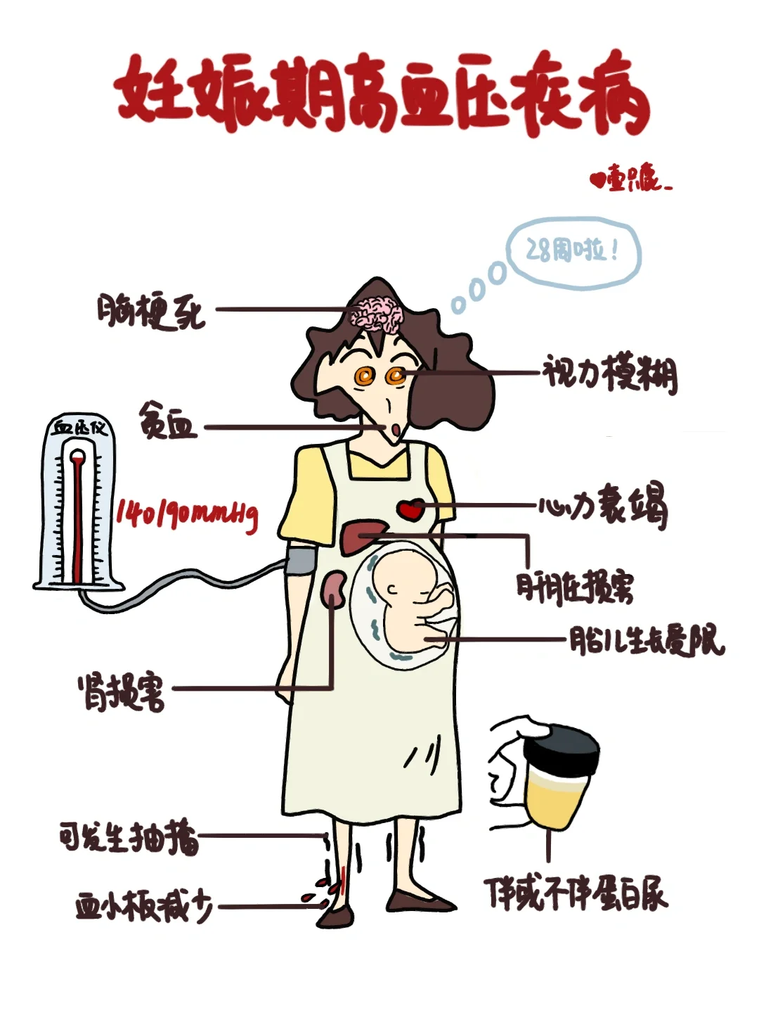 医学生笔记📒｜妊娠期高血压疾病👩‍⚕️