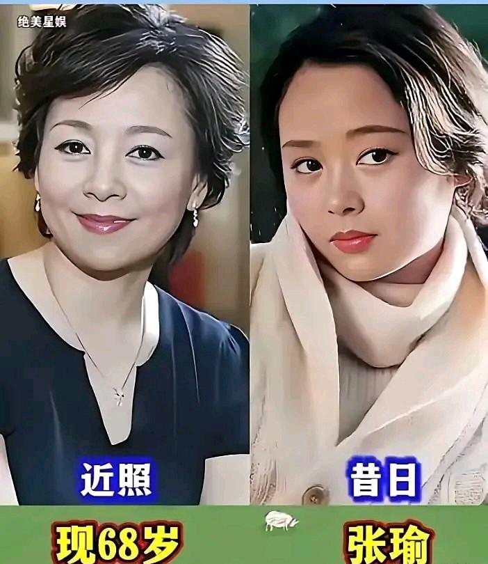 张瑜的面相属于禁老的那一种，五官特别精致稍微紧凑，脸型属于偏圆的瓜子脸，是南瓜籽