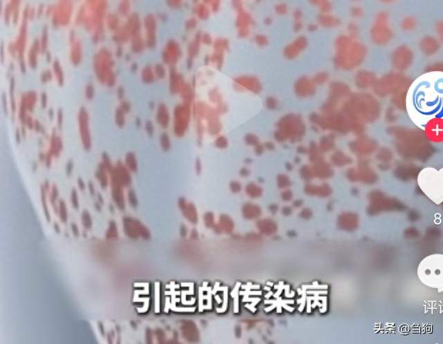 一人食、一夜情！日本年轻人的“丧狂欢”，正被梅毒螺旋体吞噬