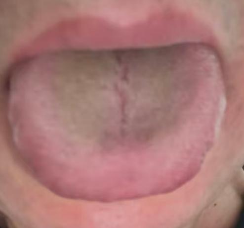 肝肾不足、湿瘀互结，男性体虚调理要分步走







很多朋友年纪轻轻就出现了