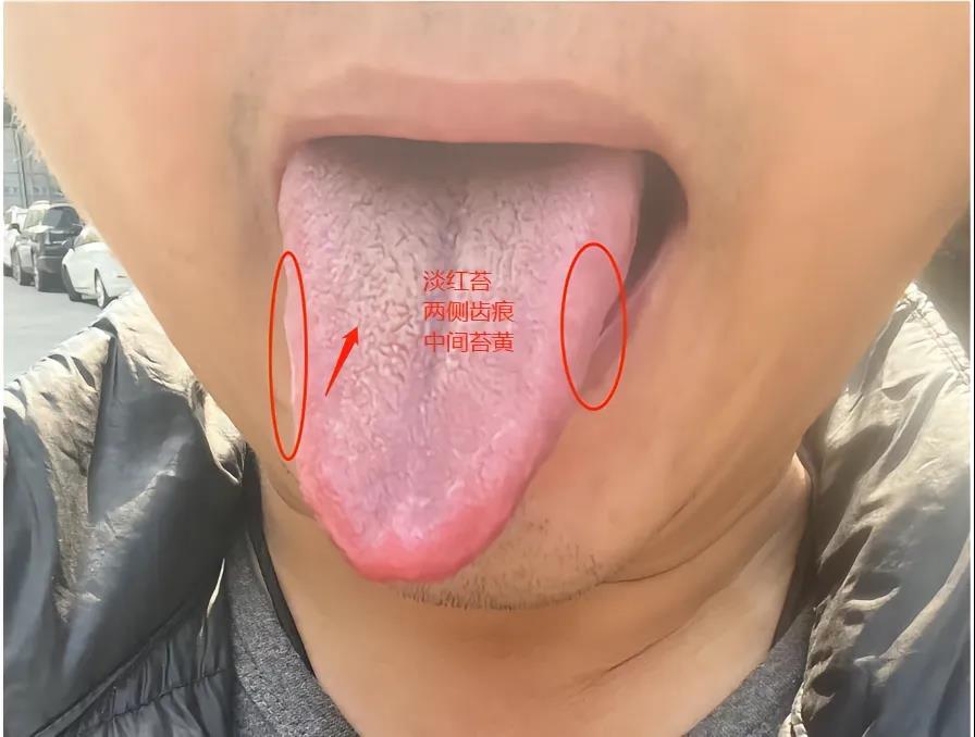 刚刚遇到一位23壮年，长了一张“大叔脸”[大笑]
小学就开始用手了[ok]，初中