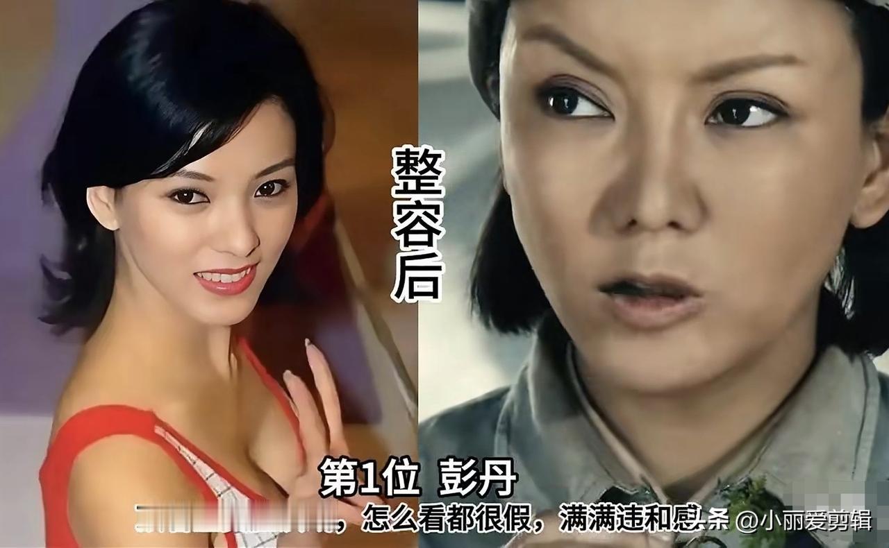 爱美是每个人的权利，但整容也有风险。颜值只是加分项，演员真正立足还是靠演技。好看