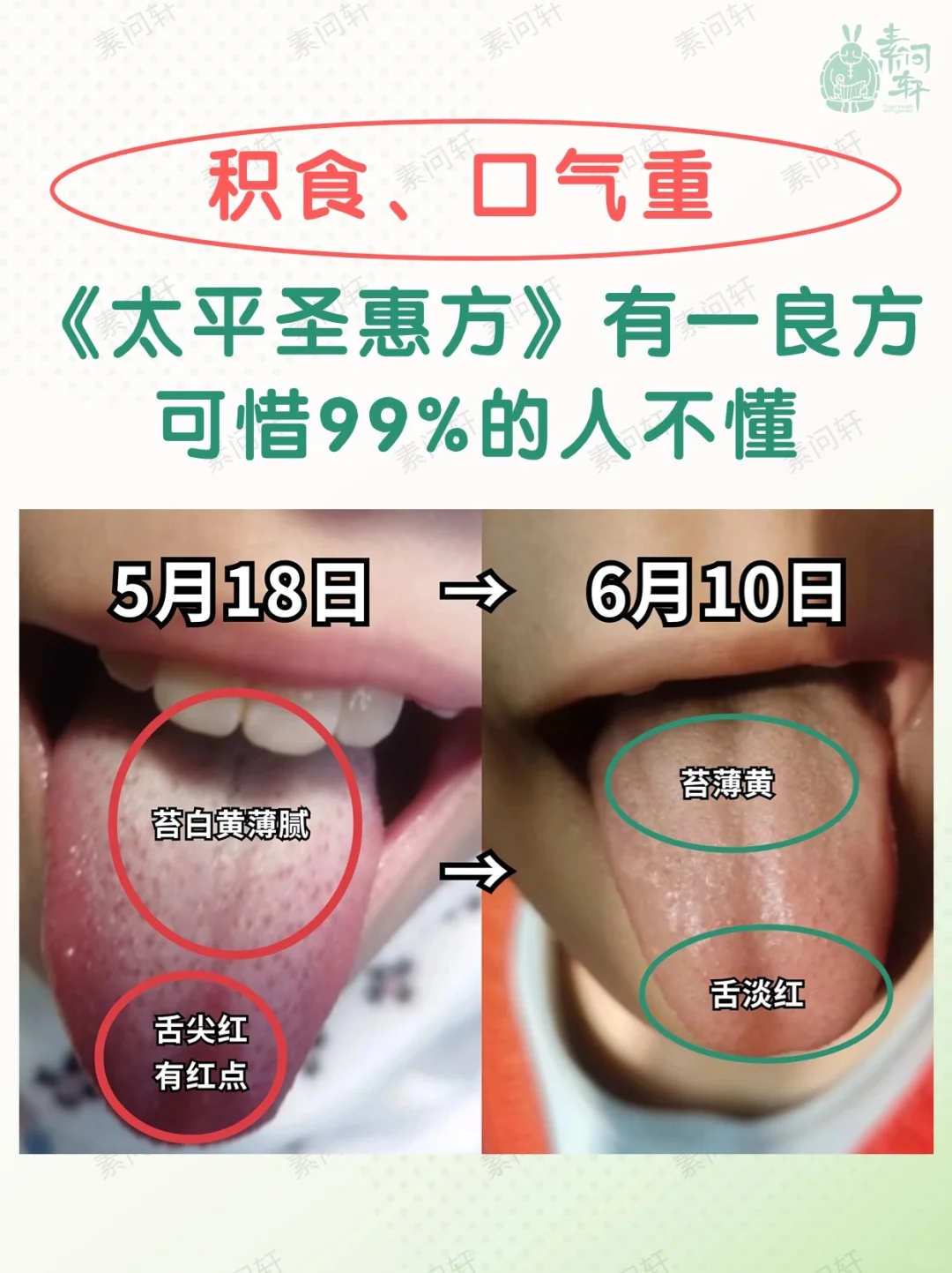 🔘小孩子积食永远是蕞蕞蕞困扰各位宝妈的问题之一。 - 🔘因为小孩子...