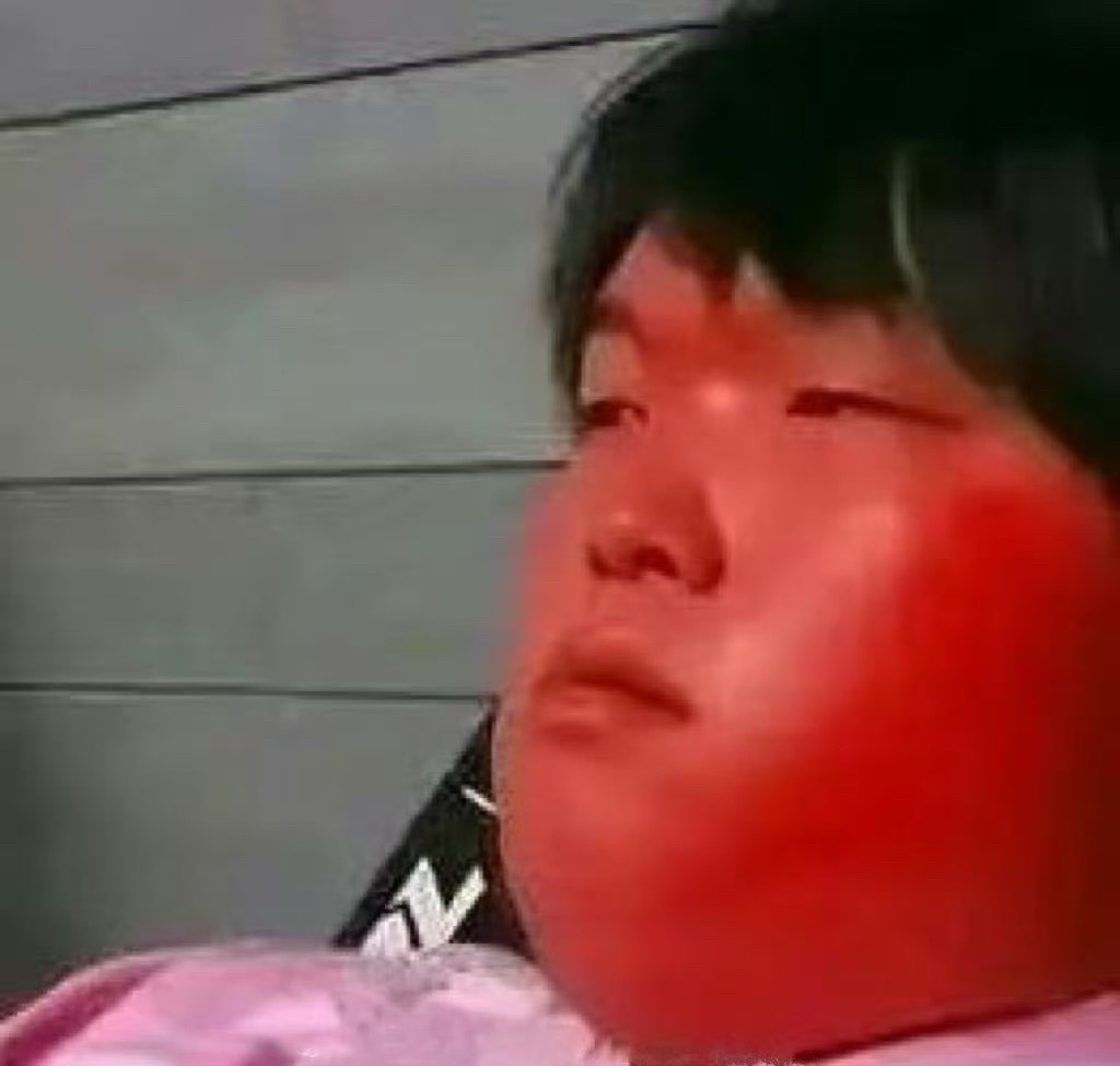 Bin怎么红温了…？这小子做双眼皮后越来越感觉不对劲了 不会在孔雀开屏吧英雄联盟