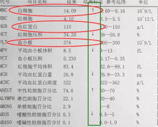 血常规这三项正常，其他就都是小事！