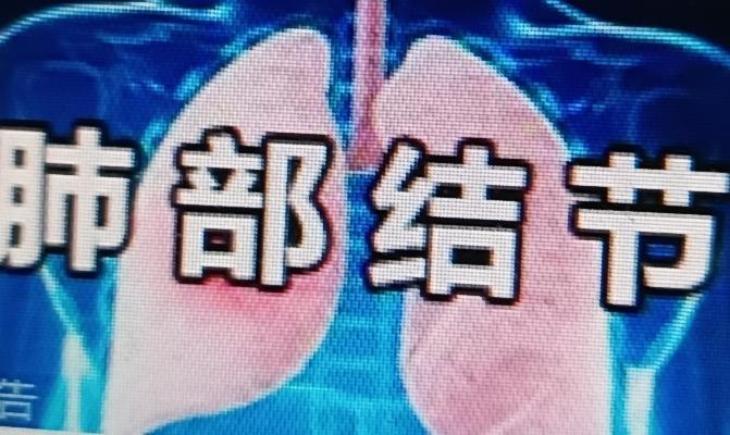 肺部结节的源头竟然和抽烟喝酒无关，第一名原因很多人天天都在做，那就是长期暴露在空