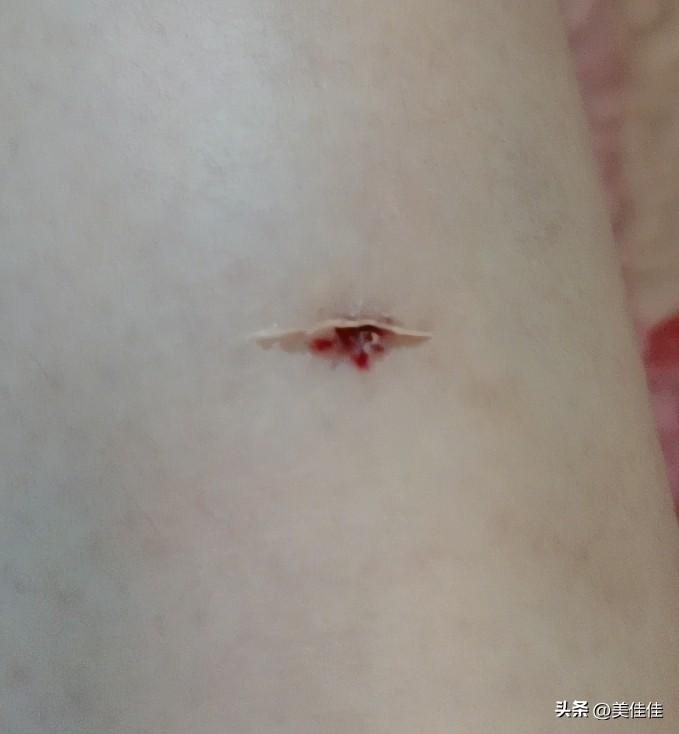今晚可真倒霉！回家路上，我正走在小道上，突然身后传来一种既像狗叫又像猫叫的声音，