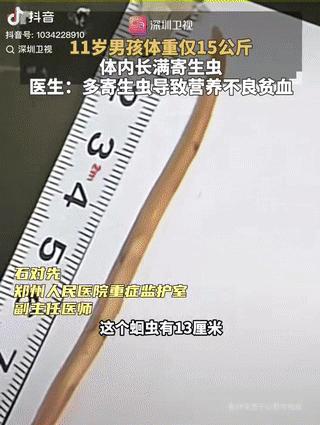 “万万没想到！”河南，11岁男孩短时间里突然暴瘦到15公斤，体重和一个两三岁的幼
