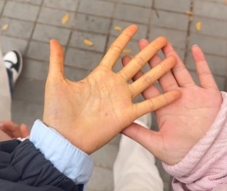 出现小黄手怎么办？
   生活里很多人都会遇到手发黄的情况，大多时候不当回事，觉