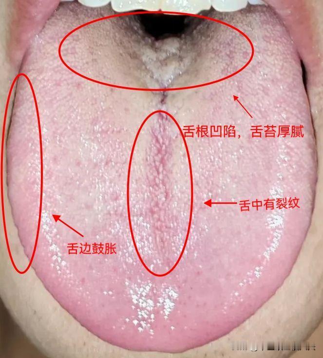 为什么肾越虚，欲望越强？

刚三十出头的大哥，平时特爱发脾气，一点小事就控制不住