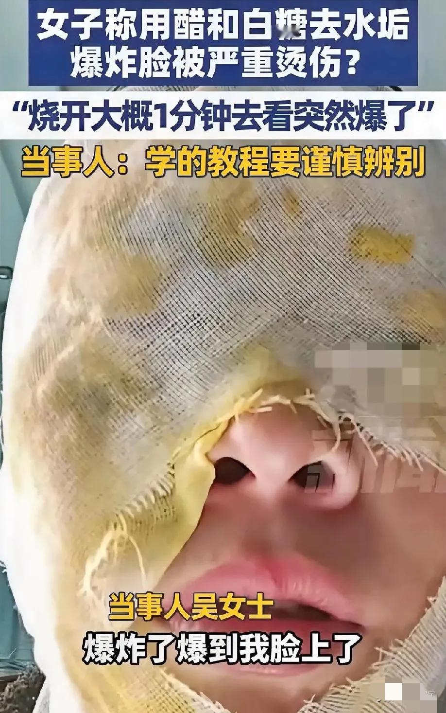 “太无知了！”
 
刷到河北女子除水垢被炸伤的新闻，真让人又心疼又气愤！

明明
