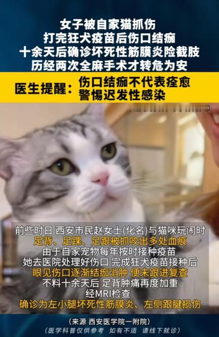 “悲剧还是发生了！”陕西西安，一女子被自家猫抓伤，接种狂犬疫苗后，见伤口结痂便没